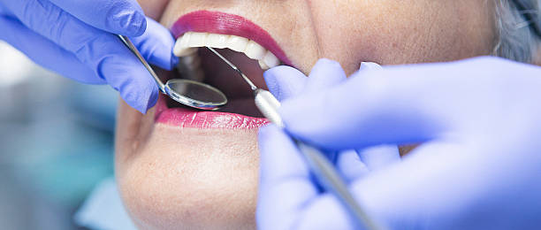 Best Broken or Chipped Tooth Repair in Gautier, MS